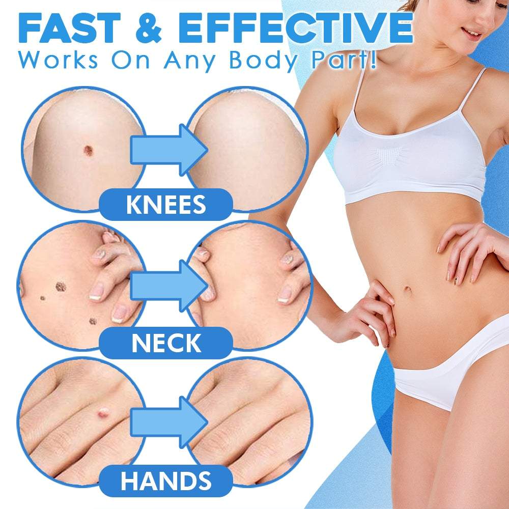 Auto Tag Removal Kit